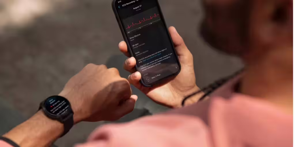 Consulter les résultats de l’ECG Garmin sur votre smartphone
