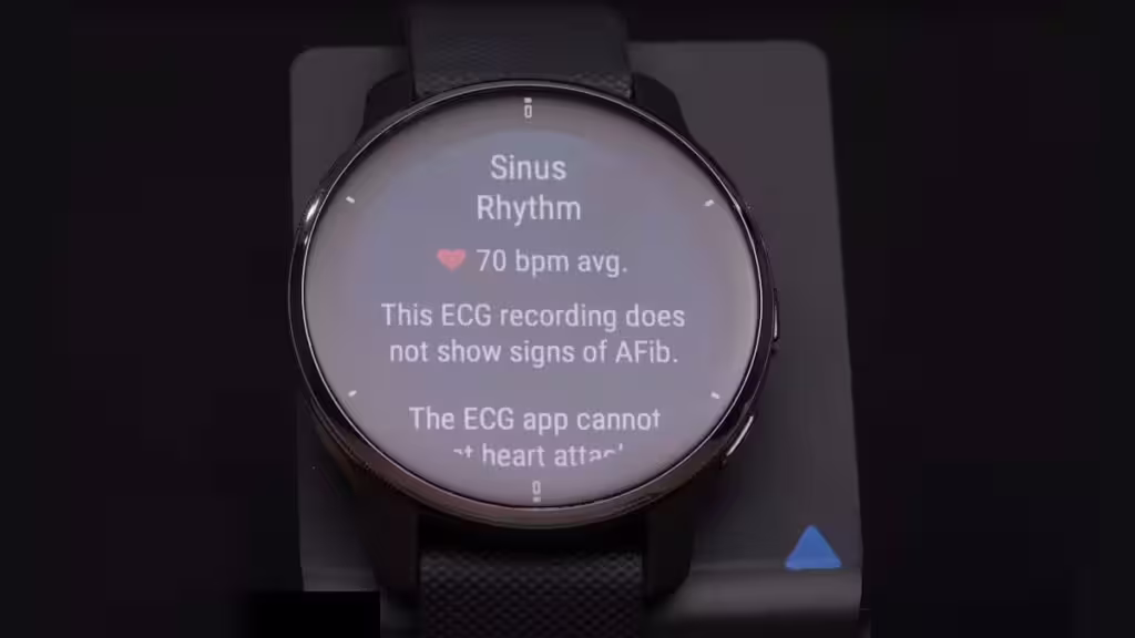 ECG Garmin